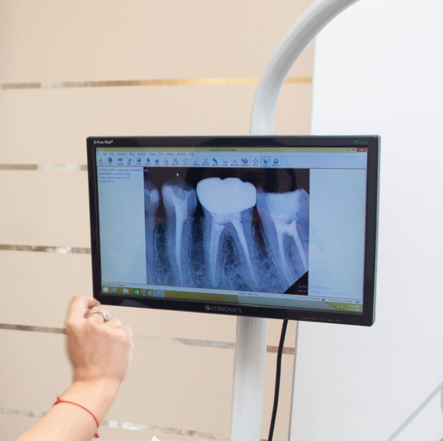 Digital dental X-ray displayed on the chairside screen